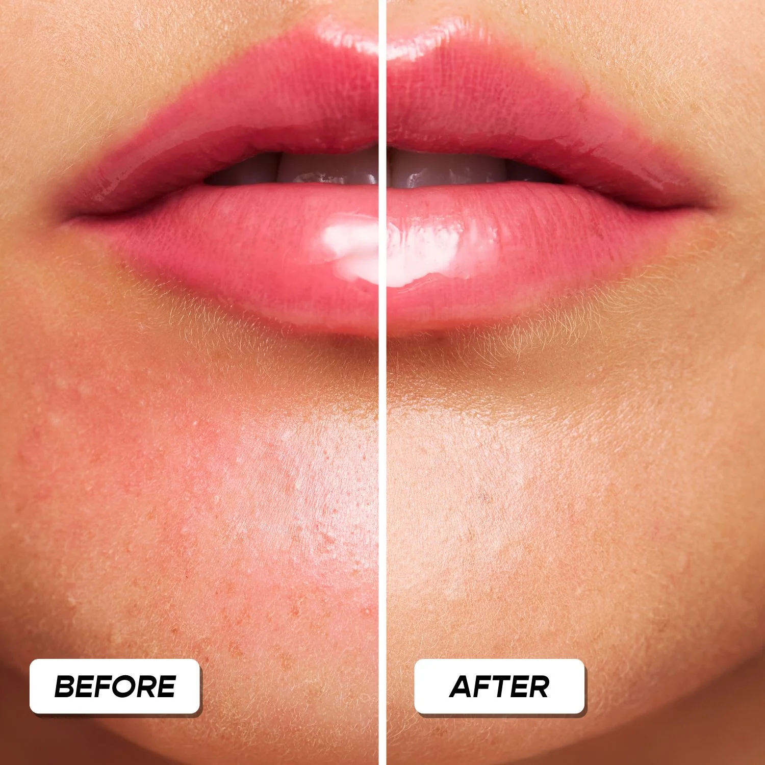 KISSING RASH REMEDY - Image 4